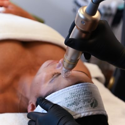 Wellington Radio Frequency Microneedling Laser Therapy